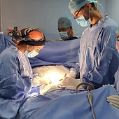 Laparoscopia