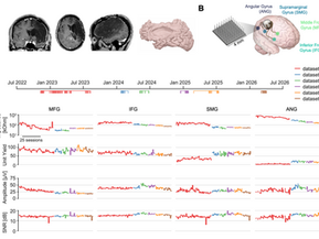 Long-term stability of cellular-resolution brain-computer interface recordings after stroke - BioRxiv, 2026