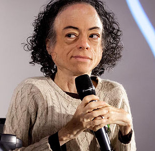 Liz Carr