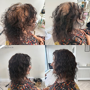 Images of a before and after of mesh integration