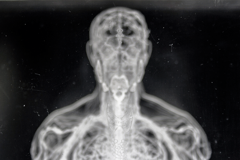 body systems illustration engraved in plexi glass