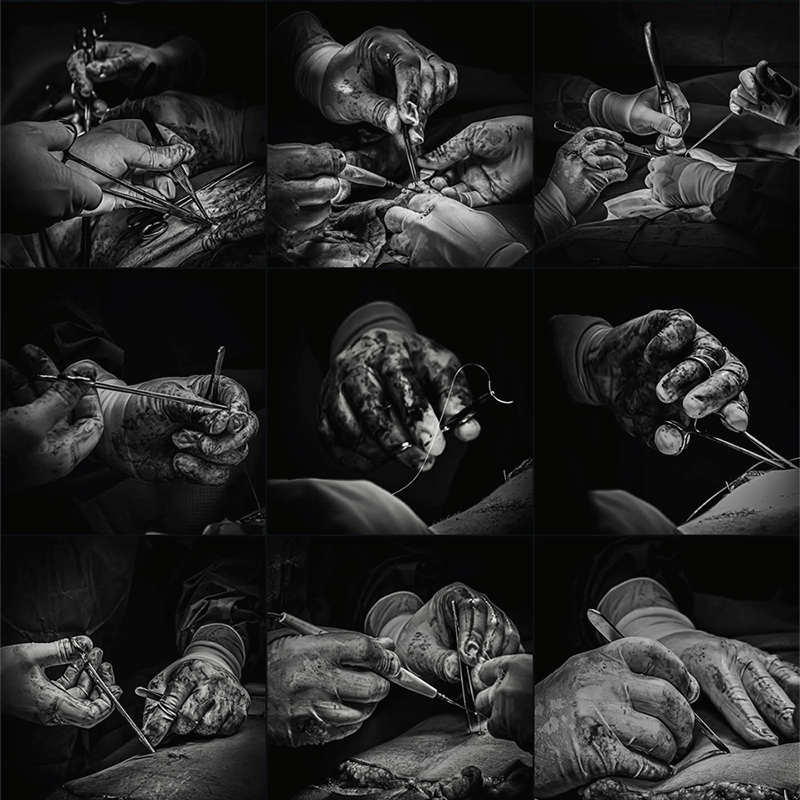 plastic surgery black and white photos