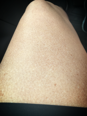 Oh My! My Tan Looks Horrible and it’s Day #2
