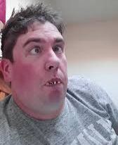 Local Retard Happy Gary’s Wild Quest for Glory at Global Operator Games