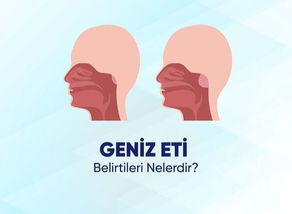 Geniz Eti Belirtileri Nelerdir ?