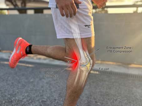Dolor de rodilla al correr: Por qué la culpa es de tu cadera (y de tu tobillo)
