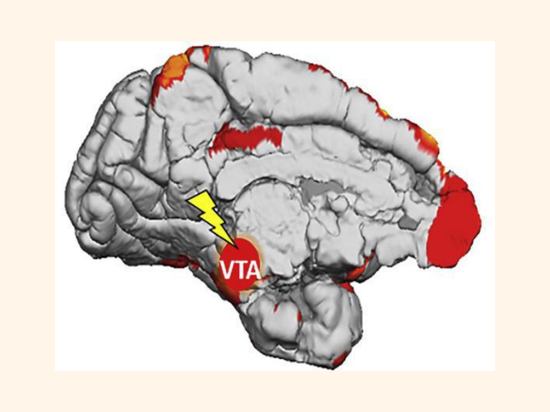 Sindrome Cuore spezzato