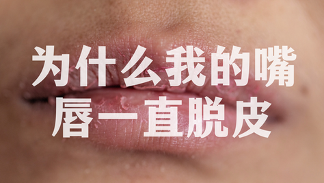 为什么我的嘴唇一直脱皮？