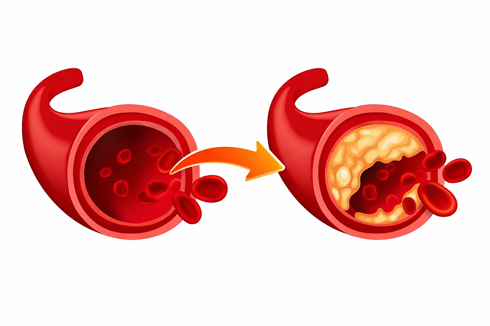 Can You Reduce Plaque in Your Arteries? A Simple Guide by a Cardiologist
