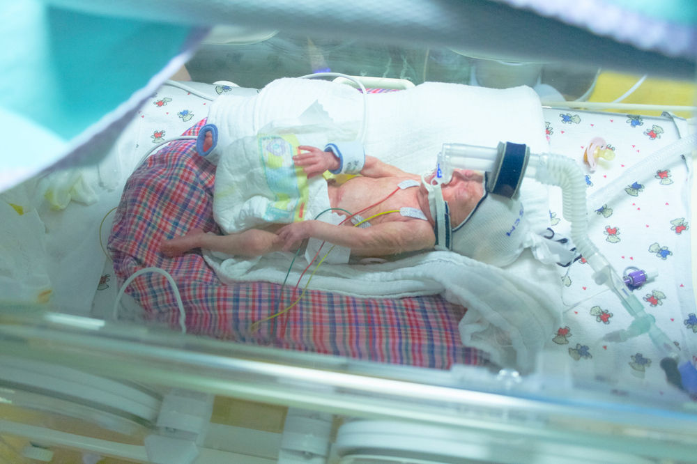 Die ersten Monate mit einem Frühchen ~ Geboren in der 25. Woche