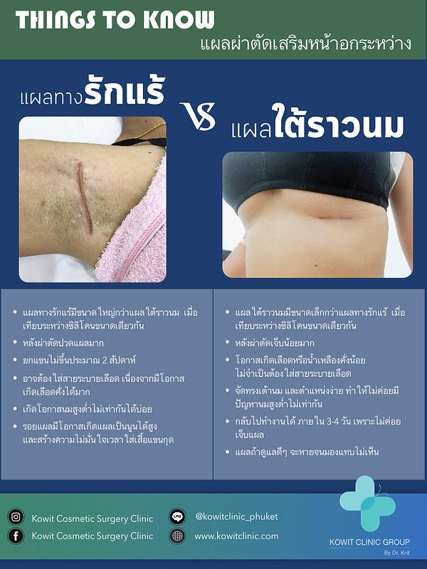 แผลผ่าตัดเสริมหน้าอกใต้ราวนมและทางรักแร้