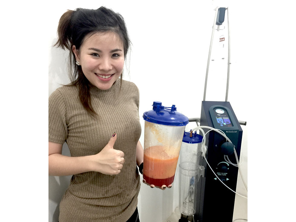 ดูดไขมันภูเก็ต bodyjet liposuction