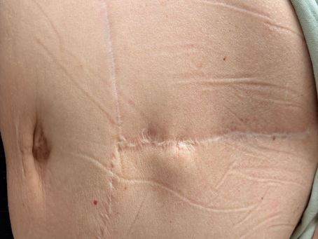 How MSTR® Scar Work Can Bring The Hidden To The Surface