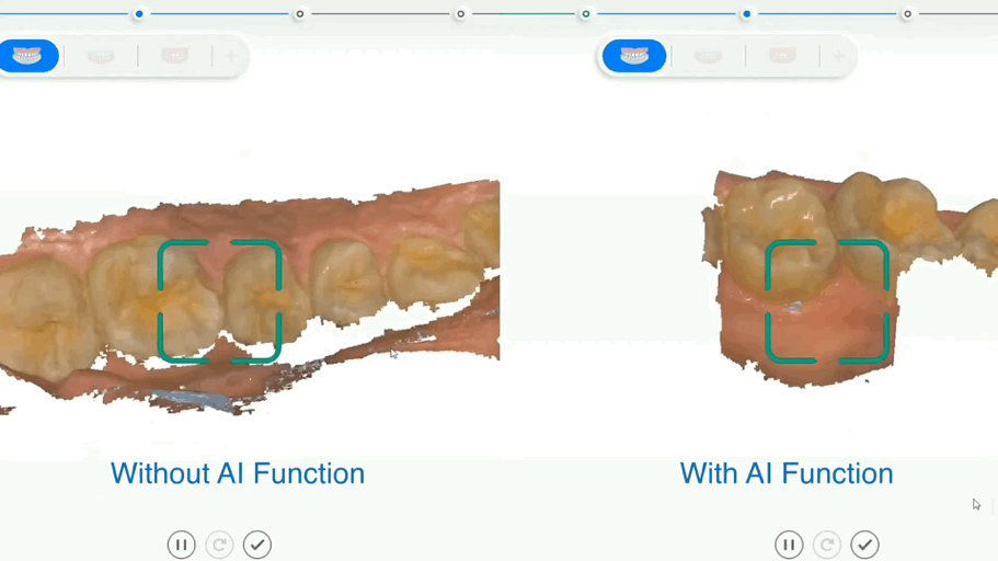 3D intraoral scanning without need for physical moulds
