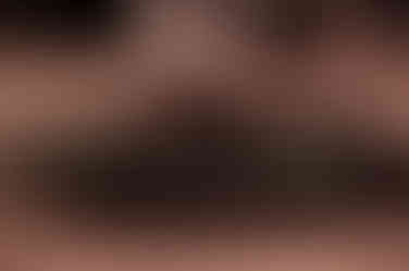 Canopy Performance: Mystic