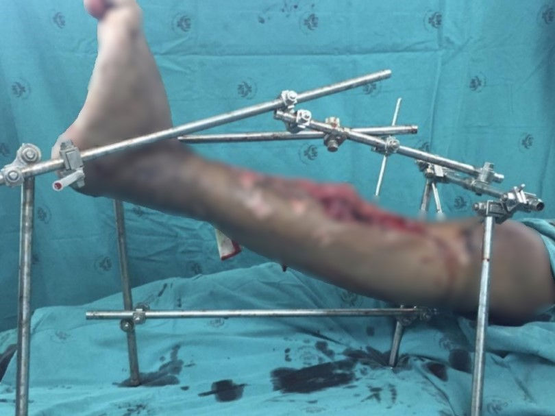 © 2025 Department of Research & Technology Assessment, Lerdsin Hospital