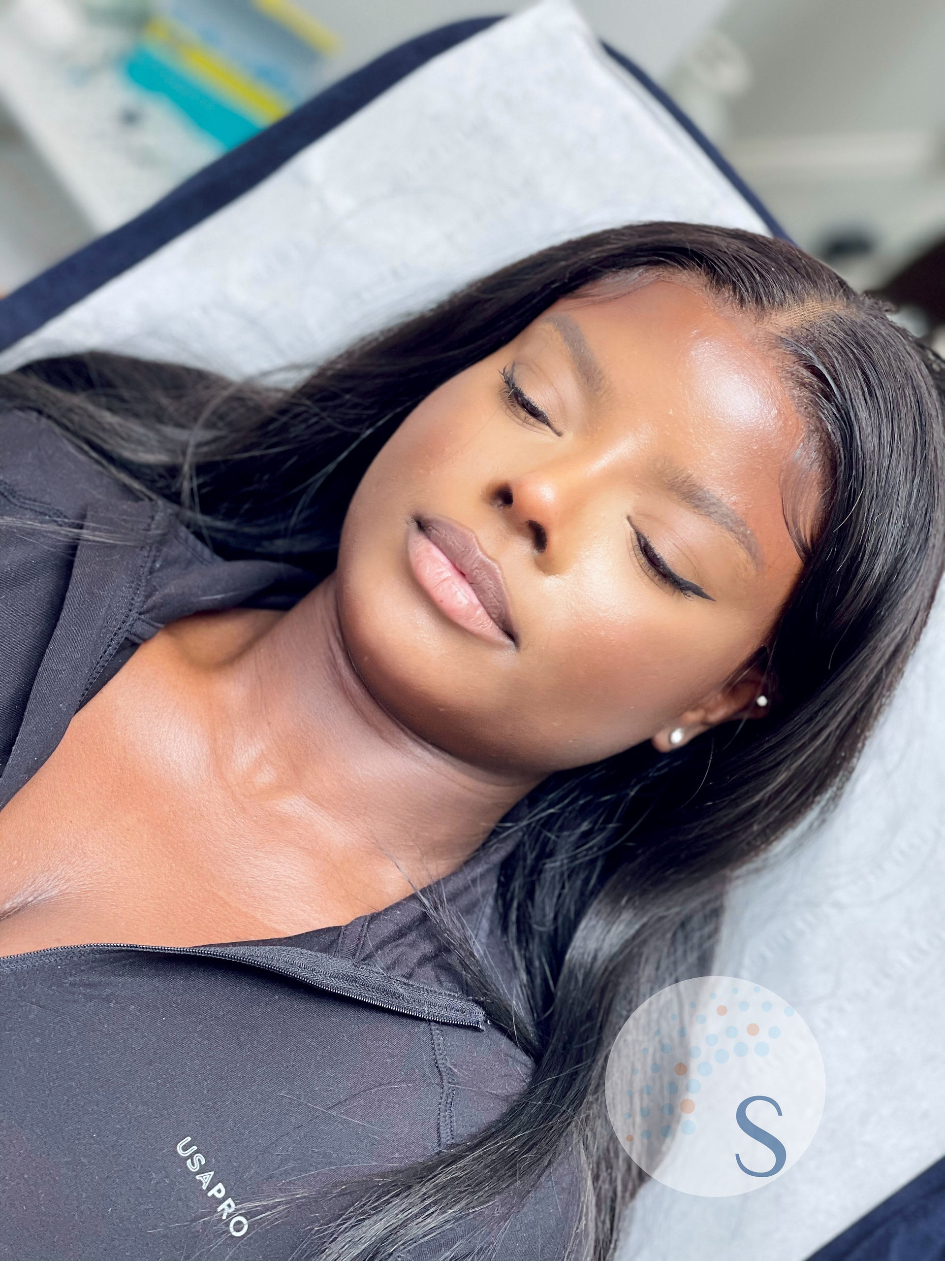 Dermal Fillers
