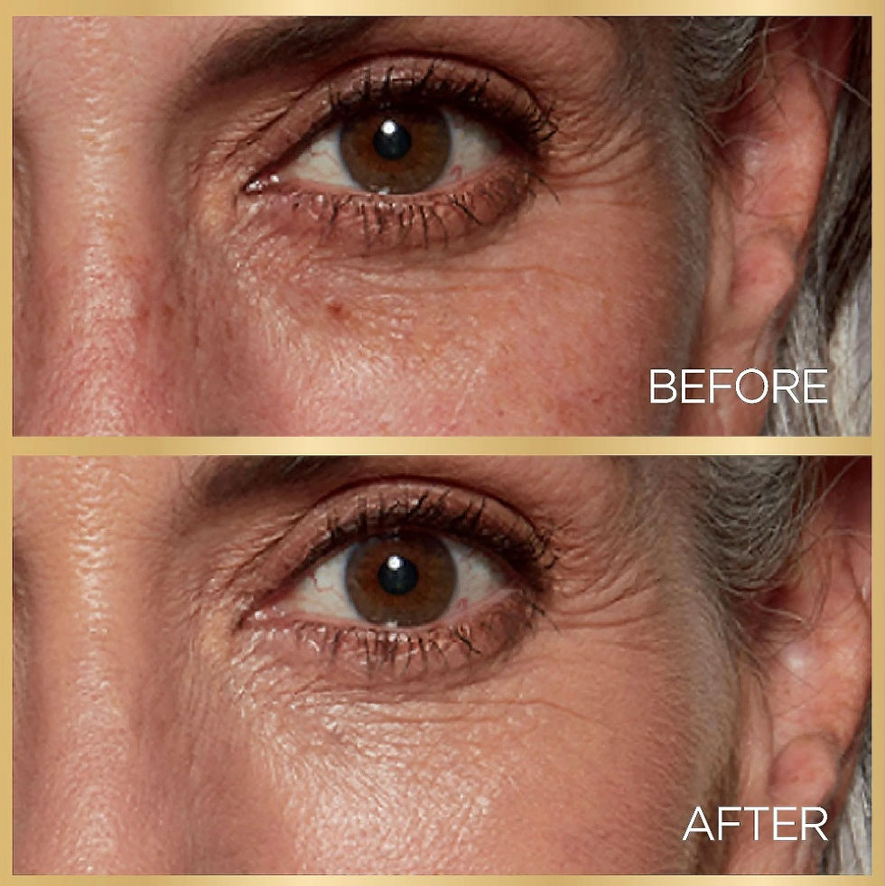 Thumbnail: L'Oreal Paris Age Perfect Radiant Serum Foundation with SPF 50, Ivory,