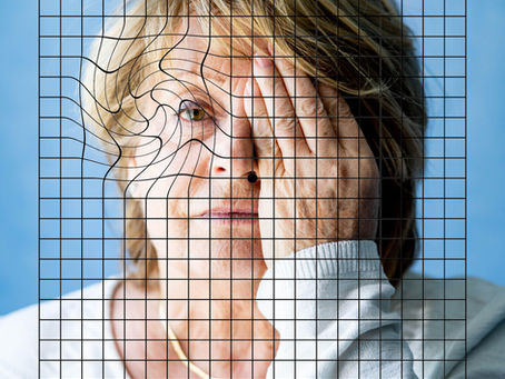 Age Related Macular Degeneration (AMD)