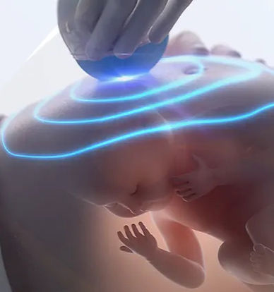 atom-ultrassonografia-obstetrica-4D-exam