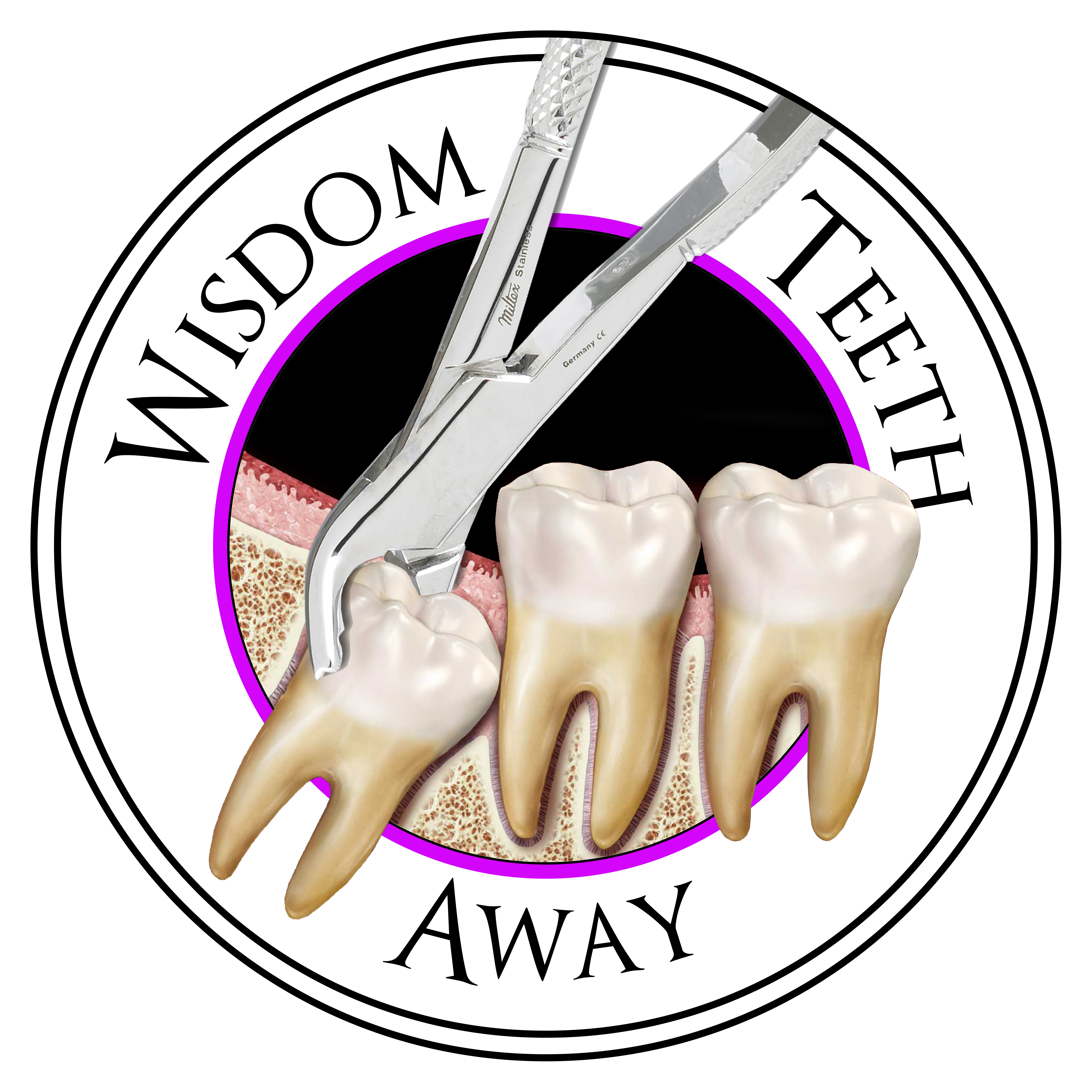 Is Tori Removal Covered By Insurance / Dental Residency Is Tori Removal Covered By Insurance / Dental Residency