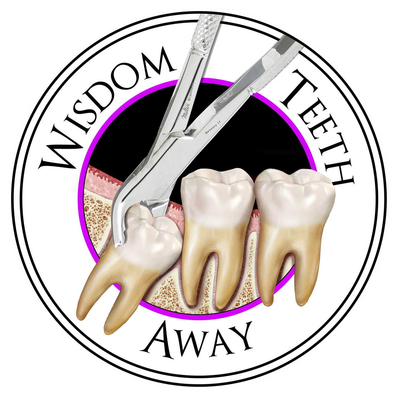 Implants Fresno Wisdom Teeth Away