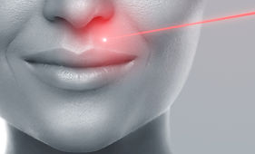 Laserakupunktur