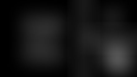 Auxin and Cytokinin Regulate Growth dynamics underlying carpel initiation in Arabidopsis