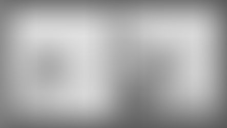 Ultra-Fast Plant Defense: High-Speed Rupture of Tomato Glandular Trichomes