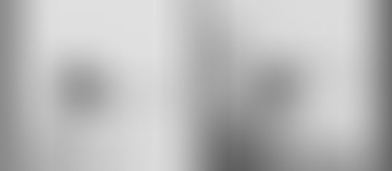 Ultra-Fast Plant Defense: High-Speed Rupture of Tomato Glandular Trichomes