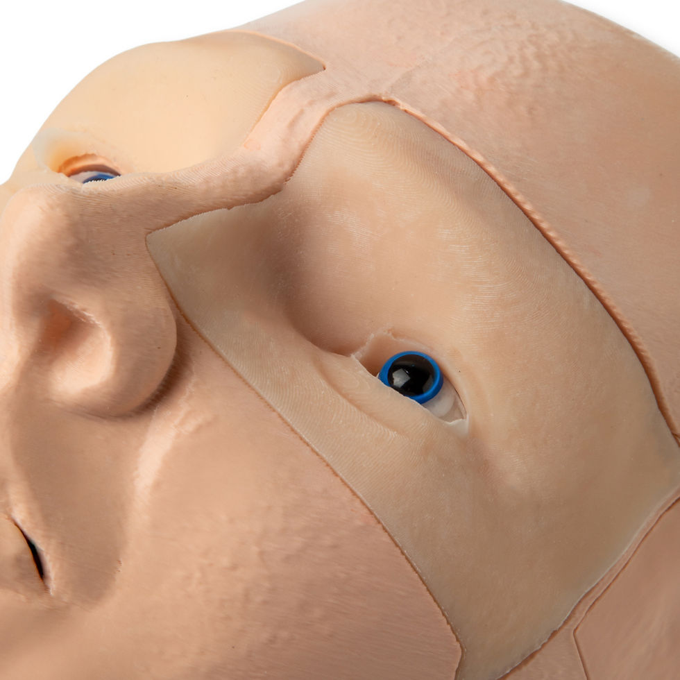 Thumbnail: Lateral Canthotomy & Cantholysis
