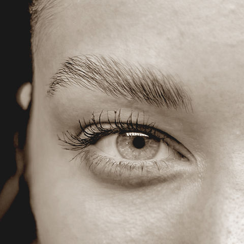 Brow-Lifting Referenzbild 2