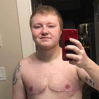 Grayson - he/him
2020 - Surgery grant