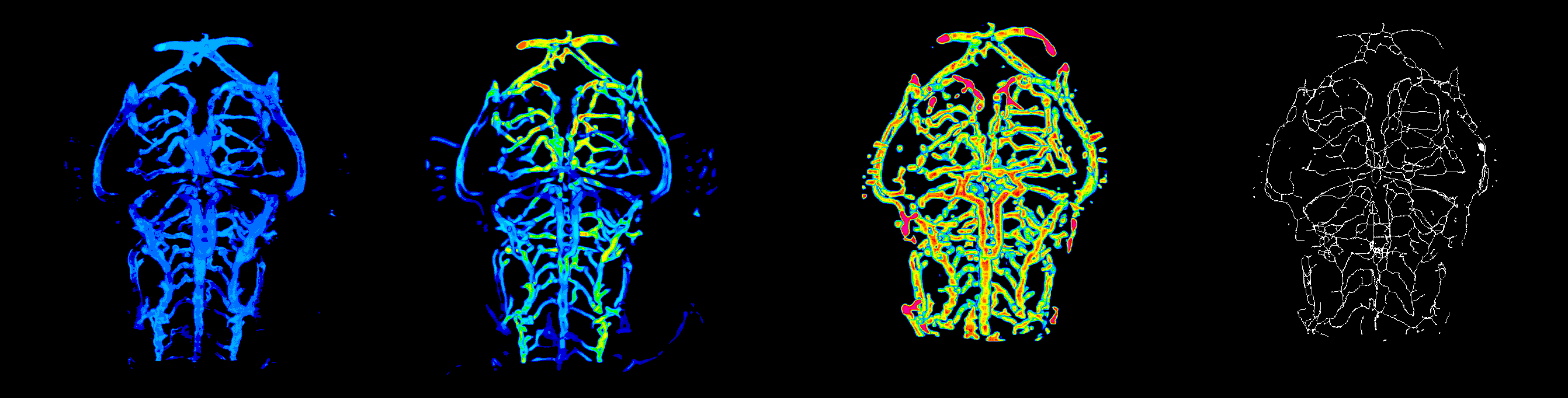 3D rendering of data analysis steps for the brain vasculature - including, the original, enhanced, segmented, and skeletonized data next to each other