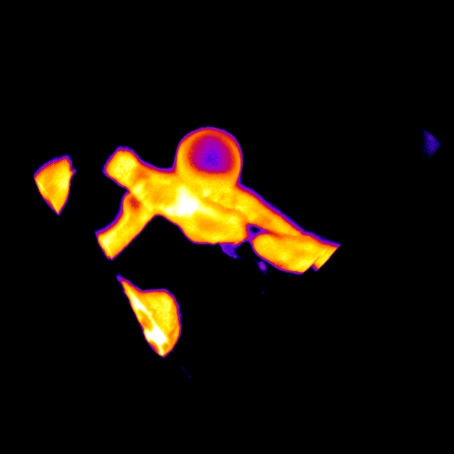 3D rendering of a kugel (endothelial cell membrane behaviour) on a blood vessel, spinning 360 degrees