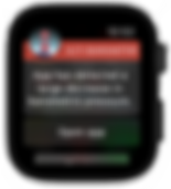 Apple Watch barometer storm alarm
