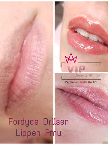 Lippen Fordyce Drüsen Permanent Make up Ingolstadt  .JPEG