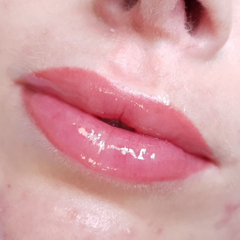 Fordyce Drüsen Pmu Permanent make up Lippen - medizinische pigmentierung , Pmu Profi Ingol