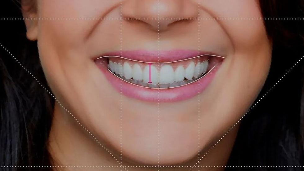 Odontologia-Estética-Dentistica-vilamariana-paraiso-sp-rizsa (1).jpg