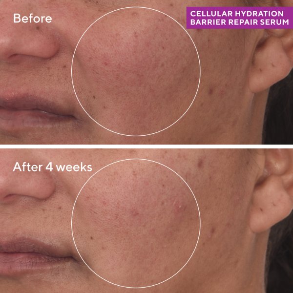 Thumbnail: Cellular Hydration Repair Cream