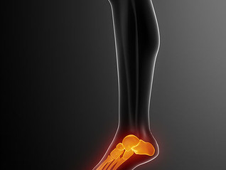 Do You Have Foot, Heel or Back Pain? We Can Fix That.