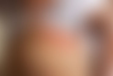 Skin Rashes That Doctors Don’t Want You to Ignore