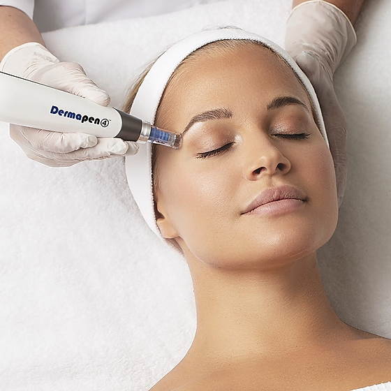 Skin-Divinity-DermaPen-4_webp.webp