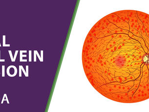 Central Retinal Vein Occlusion (CRVO) Ayurvedic Treatment