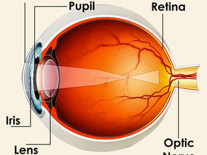 High Myopia Symptoms Type Causes & Treatment