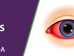 Uveitis Symptoms Causes & Treatment