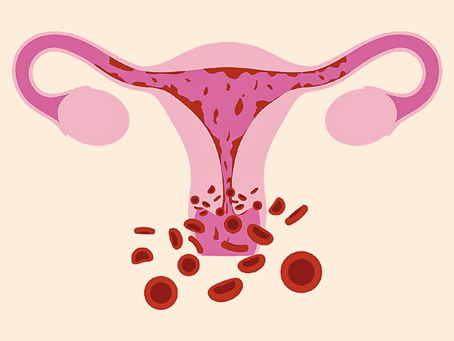 Menorrhagia Types Causes Symptoms Diagnosis & Treatment