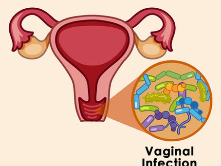 Vaginal infections Types, Causes, Symptoms, Diagnosis & Treatment