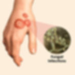Fungal Infections Causes Symptoms & Treatment
