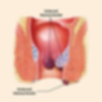 Hemorrhoids Causes Symptoms & Side Effects